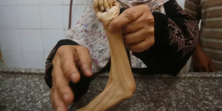 UNRWA: Israel Gunakan Kelaparan Sebagai Senjata Perang di Gaza