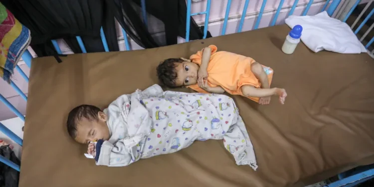 Gaza Terancam Kelaparan Massal: Lebih dari 87 Anak Meninggal karena Malnutrisi