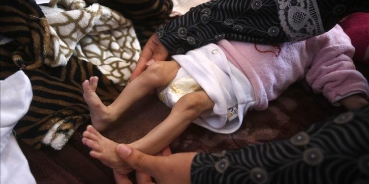 ICEF: Ribuan Bayi Gaza Terancam Nyawa Akibat Krisis Gizi dan Akses Bantuan yang Terbatas