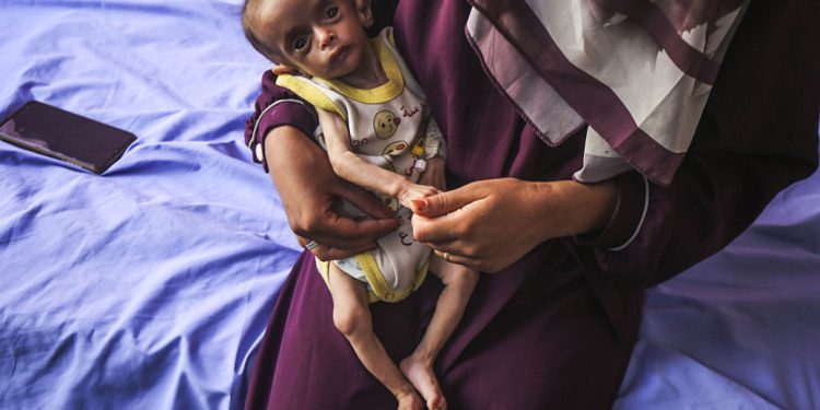 Dia Menghilang di Hadapanku: “Anak-anak Gaza adalah Korban Paling Rentan dari Kelaparan yang Dipaksakan Israel”