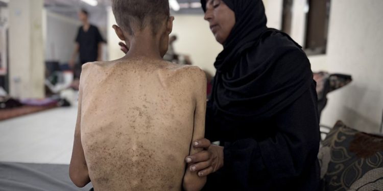 Gaza Dilanda Kelaparan dan Serangan Israel, Ratusan Ribu Warga Terancam