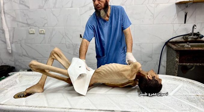 Kelaparan Mematikan di Gaza: Dua Warga Meninggal, Total Korban Tembus 159 Jiwa