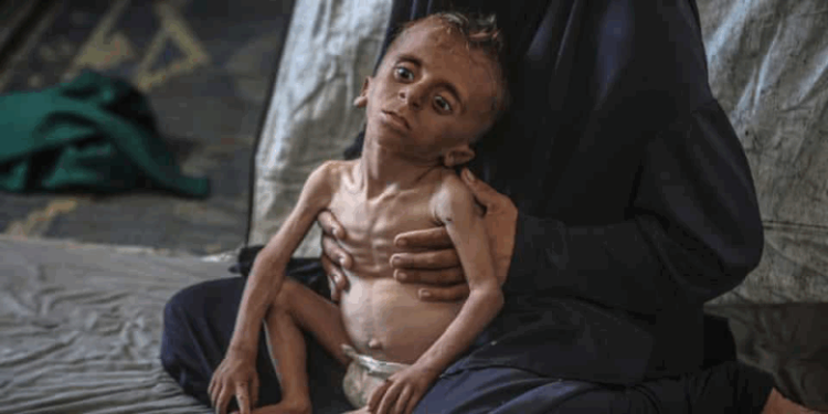 Lebih dari 100 LSM Desak Israel Hentikan Penggunaan Bantuan sebagai Senjata di Gaza