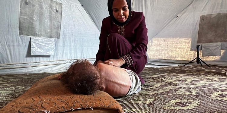 Delapan Pasien Penderita Guillain-Barré Syndrome Meninggal Akibat Kelaparan Sistematis Israel