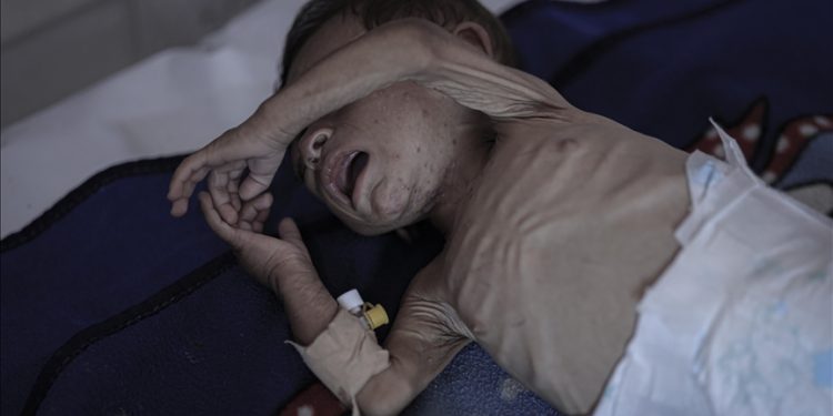 Gaza, Kuburan bagi Anak-Anak: 28 Anak terbunuh Setiap Hari, Dunia Harus Segera Bertindak