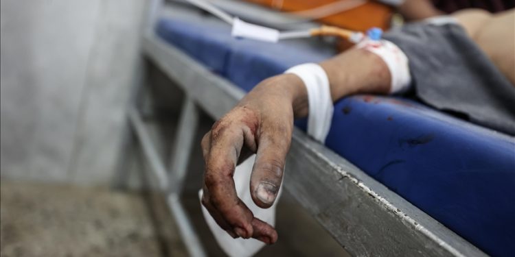 Warga Palestina yang terluka akibat serangan Israel dibawa ke Rumah Sakit al-Shifa untuk perawatan di Kota Gaza, Gaza pada 29 September 2025.