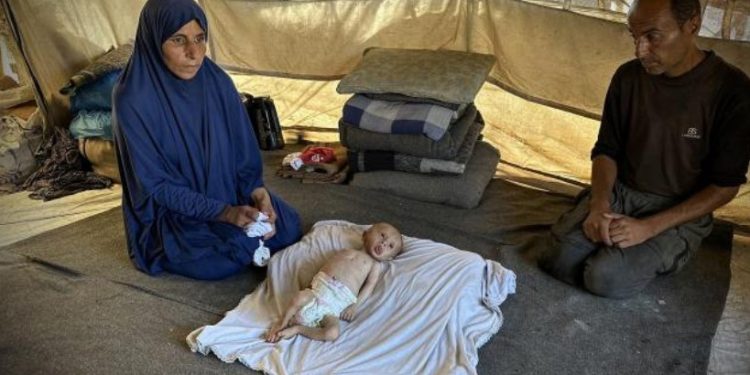Mohammad Abu Salah (4 bulan) hidup bersama keluarganya di dalam tenda pengungsian di "zona aman" Al-Masawi, Khan Yunis, Jalur Gaza (1/10). Ia menderita kelainan jantung yang menyebabkan malnutrisi parah dan saat ini sedang dirawat di Rumah Sakit Al-Nasser di Khan Yunis. Keluarganya menghadapi kondisi kemanusiaan yang memprihatinkan di tengah penutupan perbatasan oleh Israel, yang mencegah anak tersebut menerima susu, obat-obatan, dan popok yang sangat dibutuhkannya. (ActiveStill)