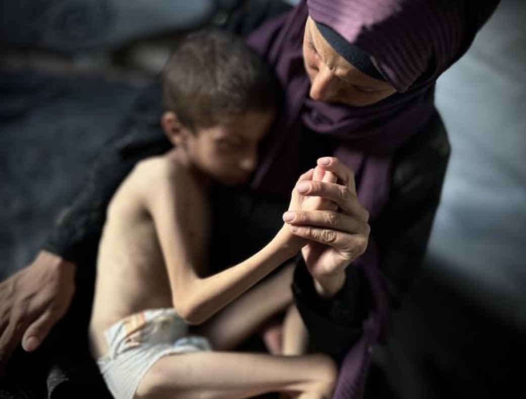Reem Nasr, seorang ibu dari tujuh anak, menggendong putranya, Nafez (10 tahun) yang semakin kurus hingga tersisa delapan kilogram akibat malnutrisi parah (3/10). Ia dan keluarganya tinggal di sebuah tenda kecil di Kamp Nuseirat, setelah mengungsi dari Gaza utara. Mereka berjuang melawan kelaparan dan penyakit karena kurangnya akses terhadap makanan, obat-obatan, atau layanan kesehatan yang layak akibat pengepungan Israel yang masih berlangsung. (Doaa Albaz/ActiveStill)