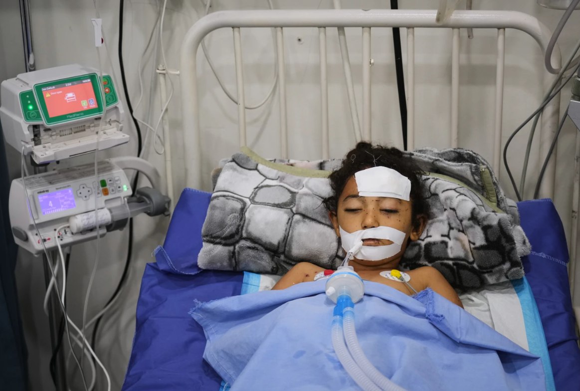 Sebuah bom di reruntuhan Gaza melukai Yahya dan Nabila, anak kembar yang mengira benda itu mainan (25/10). Mereka dilarikan ke RS Shifa, kemudian Yahya mendapat penanganan lanjutan di Rumah Sakit Amal Patient's Friends di Kota Gaza. Israel banyak meninggalkan persenjataan yang belum meledak dalam bentuk yang menarik, seperti makanan kaleng, bola, atau mainan sehingga membahayakan anak. (Abdel Kareem Hana/AP)