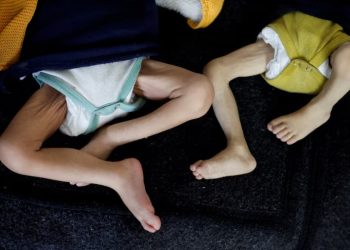 Potret kaki dua bayi di Gaza yang menderita malnutrisi (Reuters)