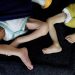 Potret kaki dua bayi di Gaza yang menderita malnutrisi (Reuters)