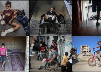 6.000 Penyandang Amputasi di Gaza Butuh Rehabilitasi Jangka Panjang