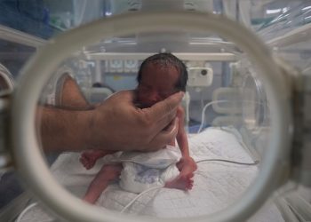 Krisis Gizi dan Medis Picu Lonjakan Kelahiran Prematur serta Cacat Bawaan di Gaza