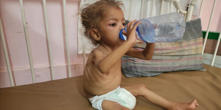 PBB: Hampir 95.000 Kasus Gizi Buruk Anak Ditemukan di Gaza Sepanjang 2025