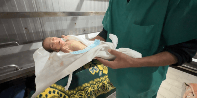 Gaza Alami Penurunan Tajam Angka Kelahiran Akibat Genosida