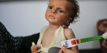 Israel Mengubah Makanan Menjadi Senjata Perang di Gaza