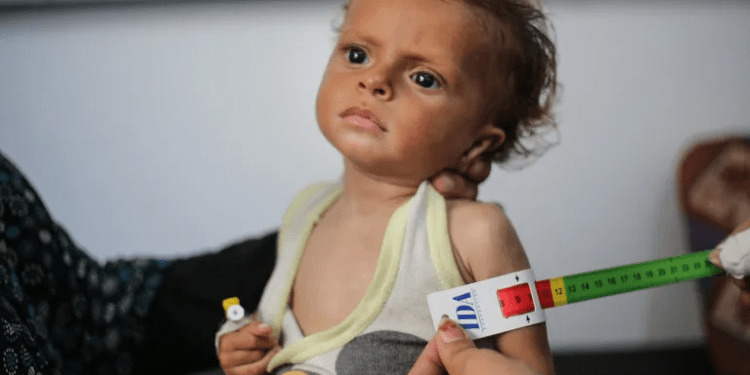 Israel Mengubah Makanan Menjadi Senjata Perang di Gaza