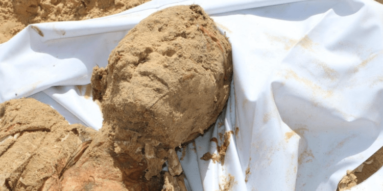 Pejabat Kesehatan Gaza Mempertanyakan Sumber Donor Organ Israel