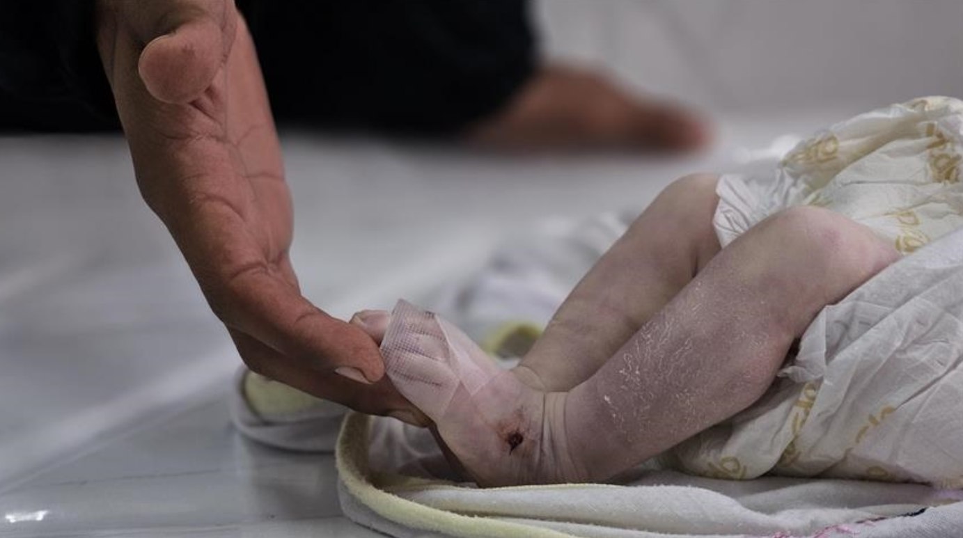 Mahmoud al-Aqraa, bayi berusia tujuh hari, meninggal dunia setelah terpapar cuaca dingin ekstrem di Jalur Gaza (10/1). Pertahanan Sipil Gaza memperingatkan bahwa krisis ini bukan sekadar akibat cuaca buruk, melainkan konsekuensi dari blokade berkelanjutan Israel terhadap masuknya material untuk tempat penampungan dan perlengkapan konstruksi di Jalur Gaza. (Anadolu/ MEMO/ Al Jazeera)