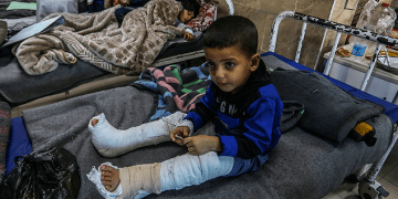 Satu Juta Anak di Gaza Membutuhkan Dukungan Psikologis