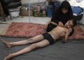 Cacar Air Ancam Anak Gaza di Tengah Gelombang Panas Ekstrem