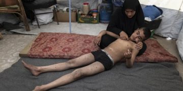 Cacar Air Ancam Anak Gaza di Tengah Gelombang Panas Ekstrem